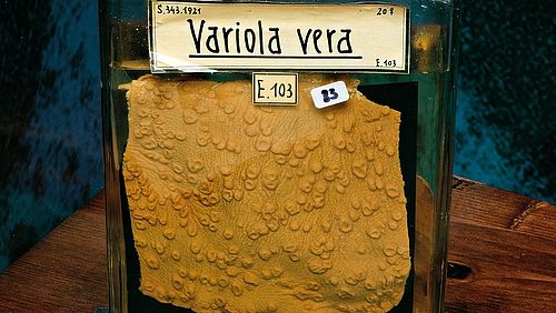 Exponat Pockenimpfung