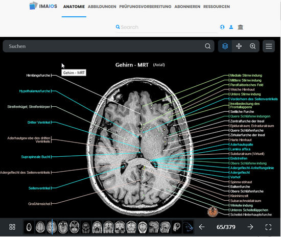 Imaios e-Anatomy 